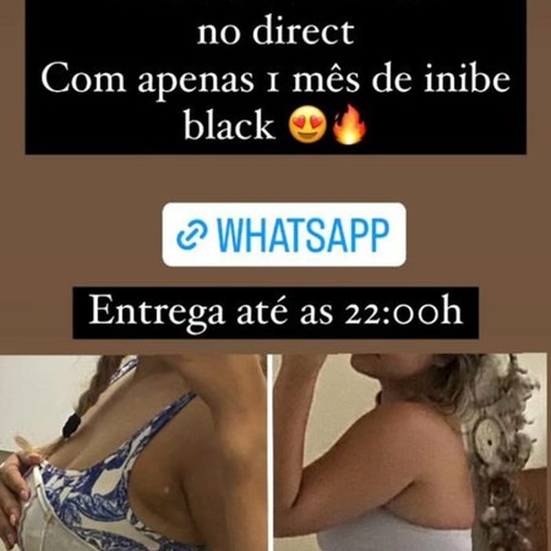 Resultado de emagrecimento com Inibe One — cliente 2